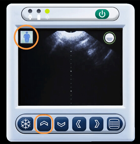 BladGo Five patient modes are available