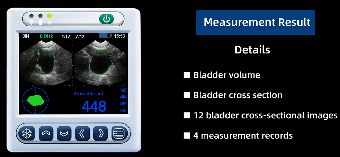 bladder scanner measurement results image