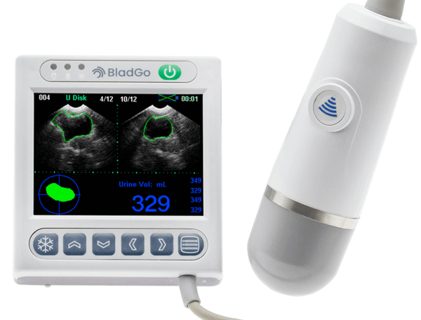 bladgo portable bladder scanner benefits