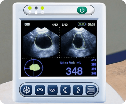 what is Bladder Scan feature image